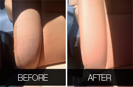 before after3
